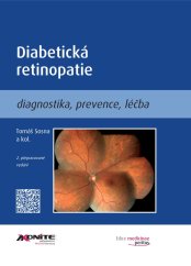 Diabetická retinopatie